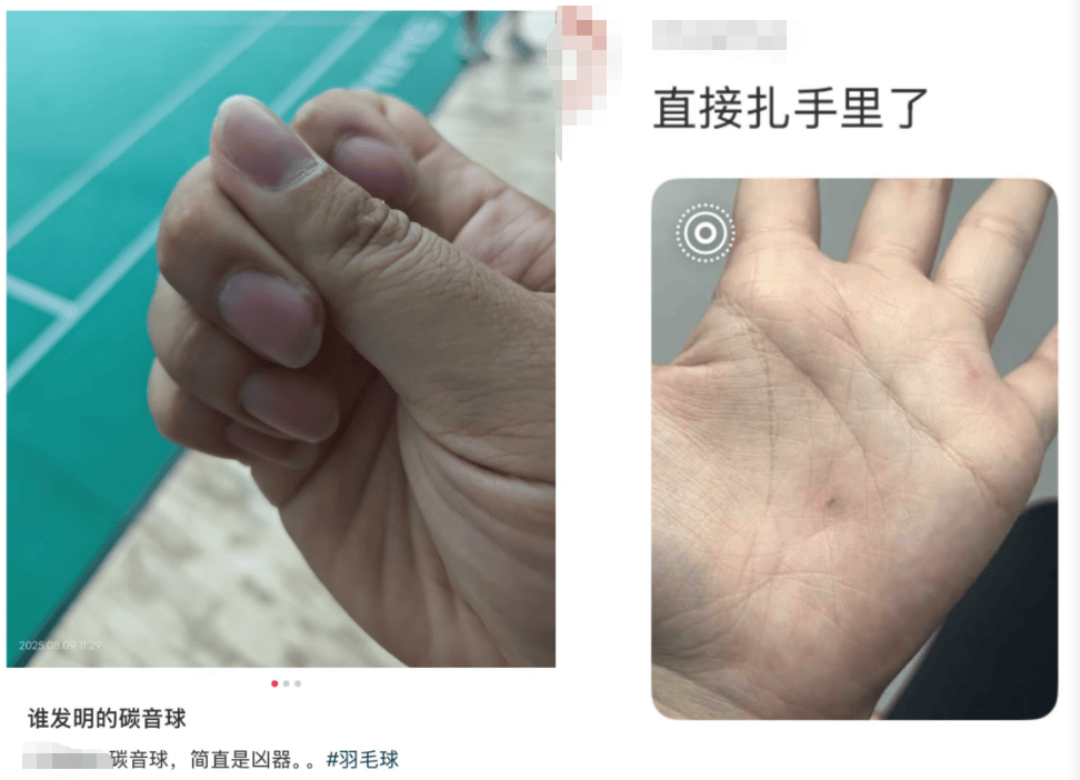 “杀伤力”惊人！击穿眉骨、扎穿手指……这项球速达300km/h的人气运动暗藏风险！